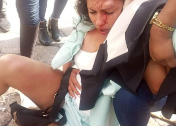 Agreden en Santa Cruz a asambleísta Muriel Cruz en puertas de Gobernación