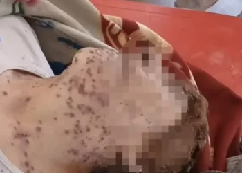 Una mujer de la tercera edad falleció tras ser atacada por un enjambre de abejas. FOTO: Captura