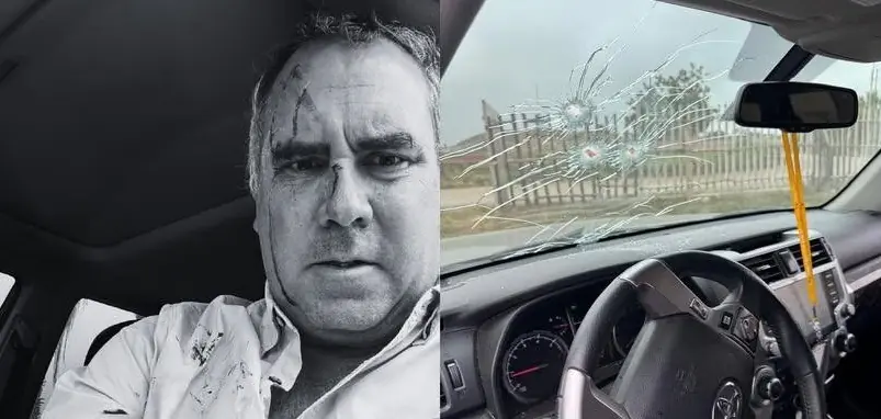 Belaunde sufrió heridas leves. Su vehículo recibió impactos de bala/RPNoticias