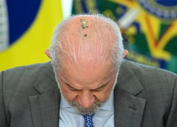 Lula fue operado de una lesión en la cabeza/AFP